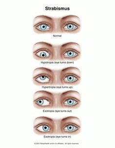 the different types of eyes and how they are used to look like them in this diagram