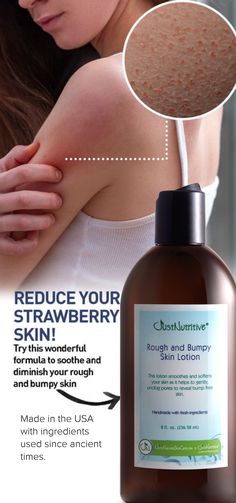 Imagine being able to shoot and disminish strawberry skin without the side effects from acne medication. Rough And Bumpy Skin, Dry Skin Lotion, Strawberry Skin, Just Nutritive, Rough Bumpy Skin, Keratosis Pilaris, Bumpy Skin, Perfect Skin Care Routine, Grooming Tips