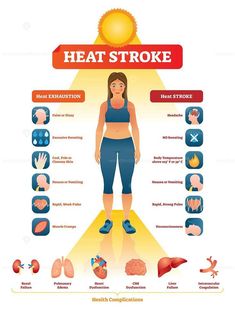 9 signs of Heat stroke & Dehydration :Understanding the Risks, Complications, and Prevention Strategies of Heat stroke Exhaustion Symptoms, Throbbing Headache, Signs Of Dehydration, Heavy Sweating, Urgent Care, Medical Prescription, Healthy Relationships