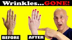 Wrinkled, Dry Hands? This Fix Makes Them Look Younger!  Dr. Mandell