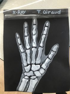 a black and white drawing of a hand with the word x - ray on it