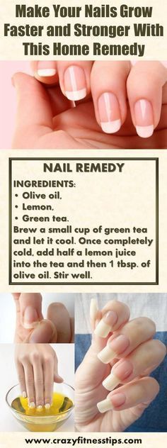 Nails Grow Faster, Nail Remedies, Longer Nails, Broken Nails, Essential Oils For Hair