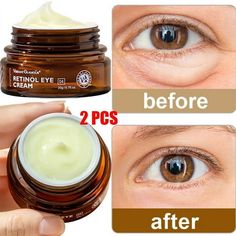 Features: 1. Our product is a new generation of retinol eye cream which contains a variety of nourishing essences, can effectively repair the eye skin, improve the fine lines around the eyes, aiming to make the eye skin bright and firm. 2. This eye cream is smooth, moisturizing, gentle and harmless, easy to absorb, suitable for all kinds of skin including sensitive skin. 3. Double retinol and arbutin have powerful anti-aging, anti-wrinkle and bright eye effects, can brighten dull skin, inhibit t Best Under Eye Cream For Wrinkles, Eye Cream For Puffy Eyes Bags, Best Eye Cream For Dark Circles, Puffy Under Eyes Bags, Puffy Bags, Eyes Bags, Best Under Eye Cream, Mouth Wrinkles, Skin Care Eye Cream