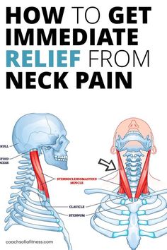 How To Release Tension In Neck, Neck Tension Stretches, Tight Neck Muscles Relief, Stiff Neck Relief Remedies, Neck Stretches For Stiff Neck, Knots In Neck Muscle, Neck Stretches For Pain, Stretches For Neck Pain, Stretches For Neck