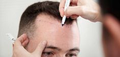 A1Services Ph. 9873310062 - Get Advanced Affordable Top 5 Hair Transplant Cilinic Near Me Delhi that works with the best clinic in Delhi. Painless & Quick Procedure with successful sessions. Affordable Top 5 Hair Transplant Cilinic Near Me Delhi is done to add more hair to an area on your head that may be thinning or balding. Affordable Top 5 Hair Transplant Cilinic Near Me Delhi Offers. Affordable Top 5 Hair Transplant Cilinic Near Me Delhi. Hair Transplant Cost, Hair Transplant Procedure, Fue Hair Transplant, Hair Transplant Surgery, Best Hair Transplant, Hair Clinic, Cosmetic Treatments, Lost Hair, Skin Clinic