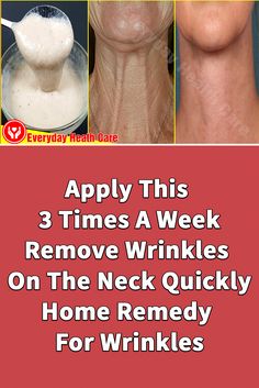 Home Remedies For Wrinkles, Neck Tightening, Wrinkles Remedies, Wrinkle Remedies, Neck Wrinkles, Skin Care Diy, Skin Care Wrinkles, Face Wrinkles