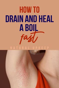 Boils have dfferent stages to go through before they mature and can be healed. Find out how to make the boil to mature, drain, and heal in a shorter period. inlcuded inside are tips on how to care for boils and prevention tips #how_to_get_rid_of_boils #armpit_boils #boils_cure #boils_remedy Armpit Boil, Essential Oil For Boils, Natural Remedies For Boils, Boil Remedies, Skin Boil, Under The Skin, How To Get Rid Of Pimples, Skin Remedies