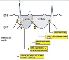 Cardiology Nursing