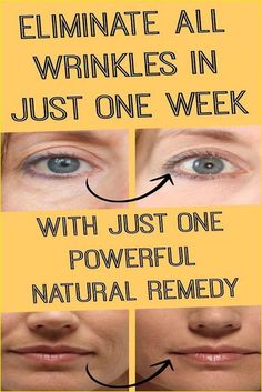 ELIMINATE ALL WRINKLES IN JUST ONE WEEK Coffee Facial, Natural Healing Remedies, Home Remedies For Hair, Diy Remedies, Lifestyle Health, Beauty Natural, Natural Therapy, Skin Complexion