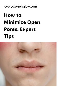 How to Minimize Open Pores: Expert Tips displayed above a close-up of a person's nose and mouth. Reduce Pores