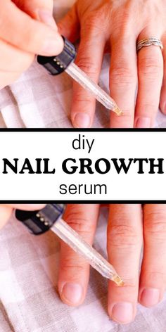 Reveal the secret to glorious natural nails. Explore my DIY nail growth serum recipe for a somewhat surprising answer to stronger nails. You’re sure to love this recipe! Homemade Nail Growth, Nail Growth Serum, Grow Nails Faster, Weak Nails, Diy Kosmetik, Broken Nails, Brittle Nails, Growth Serum