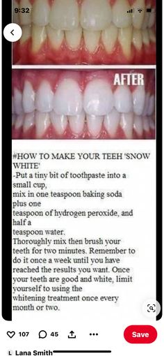 Make Teeth Whiter, Baking Soda Teeth, Natural Teeth Whitening Diy, Baking Soda Teeth Whitening, Obličejové Masky, Teeth Whitening Homemade, Baking Soda And Lemon, Teeth Whitening Remedies, Teeth Whitening Diy