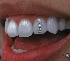 a close up of a person's teeth with braces and piercings on them