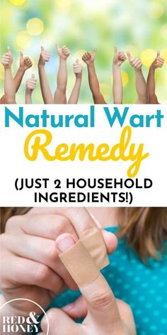 Natural Wart Remedies, Wart On Finger, Home Remedies For Warts, Warts Remedy, Cold Medicine, Get Rid Of Warts