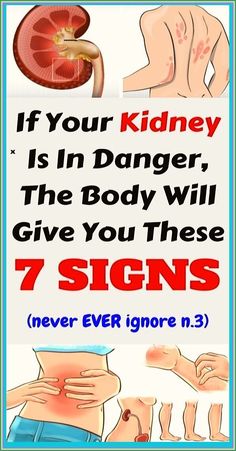 Protect your kidney health by recognizing the early signs of trouble. Learn about symptoms like fatigue, swelling, and changes in urination. Early detection can save your health. Pin this essential guide today! Health For Women, Nail Infection, Health Podcast, Health Signs, Healthy Advice, Creating A Newsletter, Health Planner, Health Dinner, Back Pain Exercises