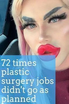 Extreme Plastic Surgery, Nose Job