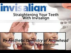 Straightening Your Teeth With #Invisalign Braces, Benefits