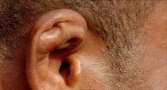 What’s that? I can’t hear you. Maybe it’s tinnitus, or impacted ear wax, or cauliflower ear (yup, that’s a thing). Find out what may be ailing your ears in this WebMD slideshow. Impacted Ear Wax, Hearing Problems, Sleep Remedies, Vicks Vaporub, Ear Wax, Keeping Healthy, Physical Wellness