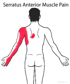 Serratus Anterior Muscle Pain image Serratus Anterior Muscle, Shoulder Blade Muscles, Serratus Anterior, Myofascial Pain Syndrome, Mid Back Pain, Trapped Gas, Angina Pectoris, Middle Back Pain, Muscle Knots