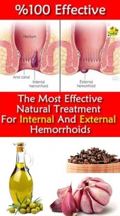 How To Treat External And Internal Hemorrhoids In Just 1 Day By FR Kitchen.Hemorrhoids(anus burning sensation) is a problem faced by many people. If you are ... Turmeric Detox Drink, Hemorrhoid Remedies, Garlic Health Benefits, Diy Health, Health Skin Care, Healthy Juices, Health And Beauty Tips