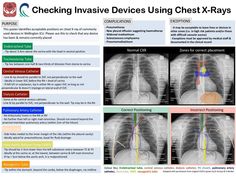 an image of chest x - rays showing the location of different areas in the chest