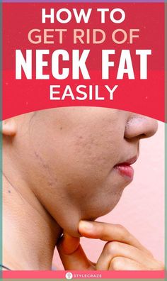 How To Get Rid Of Neck Fat Easily: Your neck tends to become heavier as you age or begin to put on weight. This can give your face a disproportionate appearance. Hence, to save you from this trouble and help you get rid of neck fat, here are some diet tips and exercises that may help. #Neck #NeckFat #Health #Fitness #Weightloss Double Chin Exercises, Chin Exercises, Put On Weight, Face Exercises, Double Chin, Lose 50 Pounds, Fish And Chips, Diet Tips