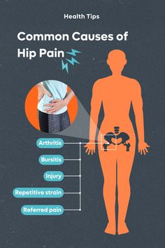 Hip pain can have a wide range of causes, including some that have nothing to do with your hip. Dr. Abhishek Kannan, an orthopedic sports medicine surgeon with Orlando Health Jewett Orthopedic Institute, discusses hip pain causes and treatment options. #ChooseWell #OrlandoHealth #Orthopedics #OrthopedicCare Hip Pain Causes, Bursitis Hip, Referred Pain, Hip Injuries, Hip Problems, Magnetic Resonance Imaging, Hip Pain, Sports Medicine