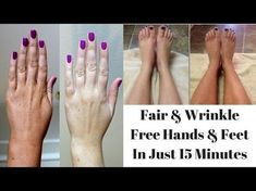 Wrinkle Free Hands, Softer Hands, Home Remedies For Wrinkles, Diy Wrinkles, Wrinkles Hands