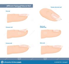 Flat Nails Shape, Nail Bed Damage, Types Of Nails Shapes, Long Nail Beds, Natural Nail Shapes, Artistic Nails