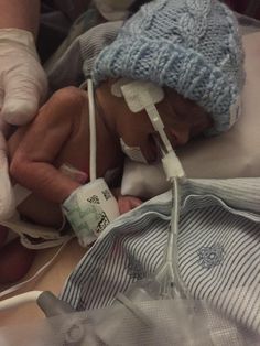 a baby laying in a hospital bed with an oxygen tube attached to it's head