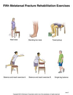 Summit Medical Group - Foot Fracture: Fifth Metatarsal Fracture Exercises Jones Fracture, Metatarsal Fracture, Bursitis Shoulder, Fracture Healing, Bone Healing, Therapy Exercises, Broken Foot, Massage Therapy Techniques