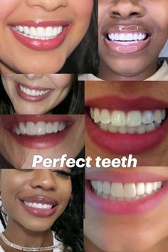 Perfect White Teeth, Mint Toothpaste, Cute Braces, Perfect Teeth, Teeth Braces, Smile Teeth