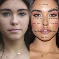 Madison Beer Plastic Surgery, Eyeliner Makeup Looks, Face Plastic Surgery, Botox Before And After, Face Fillers, Face Surgery, Cheek Fillers