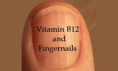 Line On Nails, Nail Health Signs, Low Vitamin B12, Fingernail Health, Nail Vitamins, Bad Acne