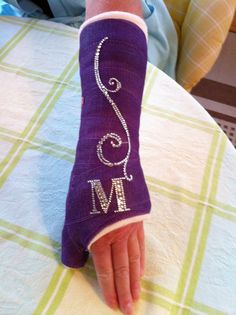 a person's hand with a purple arm cast on top of a table