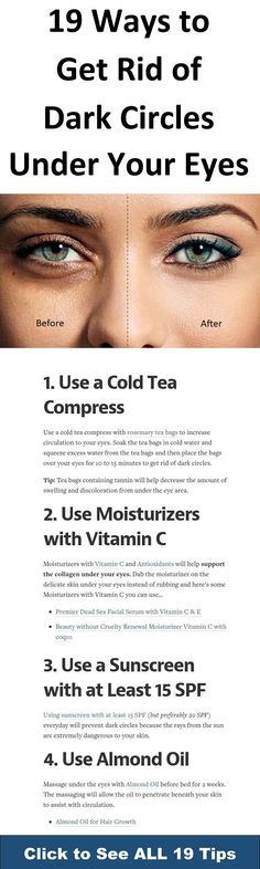 22 Ways to Remove Dark Circles Instantly → Overnight Face Mapping Acne, Eye Wrinkle Cream, Diy Eye Cream, Face Mapping, Acne Face Wash, Remove Dark Circles, Face Acne, Dark Circles Under Eyes, How To Get Rid Of Acne