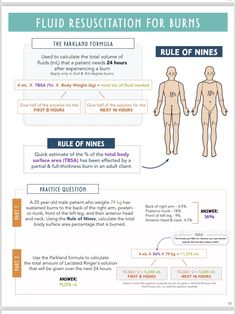 an info sheet with instructions on how to use fluid resection for burns