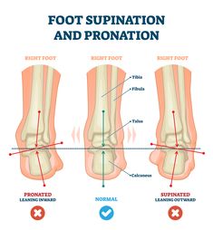 Pronation Exercises, Flat Feet Exercises, Knee Bones, Pelvic Tilt, Hip Pain, Calf Muscles, Heel Pain