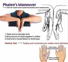 Phalen's maneuver . . . . . . . . . . . . #medicine #doctor #live #drug #medical Physical Therapy Student, Median Nerve, Physical Therapy Assistant, Physical Therapy Exercises, Medical School Studying, Medical School Essentials