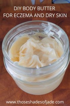 Body Butters Recipe, Dry Skin Remedies, Skin Remedies, Diy Body, Skin Care Recipes, Diy Skin Care