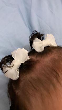 a close up of a baby's head with two bows on it