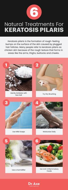 Keratosis pilaris natural treatments - Dr. Axe http://www.draxe.com #health #holistic #natural #diy Medicine Recipes, Cooking With Turmeric, Astuces Diy, Natural Healing Remedies, Diy Remedies, Skin Condition, Natural Therapy