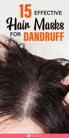 Diy Hair Mask For Dandruff, Mayonnaise Hair Mask, Hair Mask For Dandruff, Rid Of Dandruff, Homemade Hair Mask, Dandruff Remedy, Getting Rid Of Dandruff, Best Hair Mask, Hair Dandruff