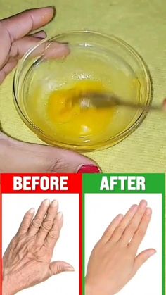 Home Remedies For Wrinkles, Homemade Wrinkle Cream, Natural Skin Care Ingredients, Clear Healthy Skin, Natural Skin Care Remedies, Diy Skin Care Routine, Natural Face Skin Care, Good Skin Tips, Diy Skin Care Recipes