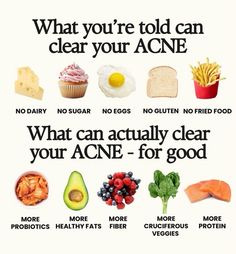 Tired of harsh topical treatments? Explore the power of your plate! This guide dives into foods rich in essential nutrients that can help combat acne from the inside out, promoting clearer and healthier skin. Foods And Benefits, Foods That Prevent Acne, Foods That Are Bad For Your Skin, How To Reduce Cravings, Foods That Age You, Foods To Help Your 🍒 Grow, What Foods Cause Acne, Foods That Trigger Acne, Foods That Help Skin