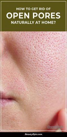 Minimize Pores Naturally, Big Pores, Face Pores, Beauty Hacks Skincare, Open Pores, Smaller Pores, Natural Face Skin Care, Make Up Videos, How To Get Rid Of Pimples