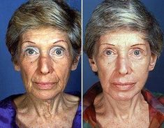 Facial Exercises For Men, Gymnastics Exercises, Facial Workout, Facial Yoga Exercises, Facelift Without Surgery, Face Lift Exercises, Sagging Face, Face Tone, Natural Face Lift