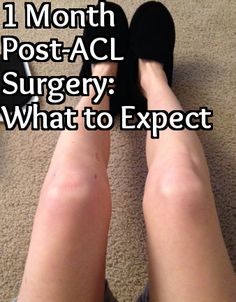 ACL Post-Surgery Week 4 Acl Rehab Physical Therapy, Post Acl Surgery Workout, Acl Surgery Recovery Tips, Acl Recovery Timeline, Acl Aesthetic