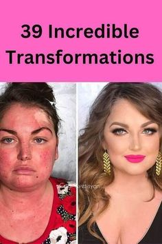 Power Of Makeup, Makeup Looks For Brown Eyes, Makeup Transformation, Bride Makeup, Inspirational Women, Plastic Surgery, Fashion Makeup, Womens Makeup