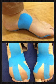 Arch Support High Arches, Heel Pain, Foot Pain